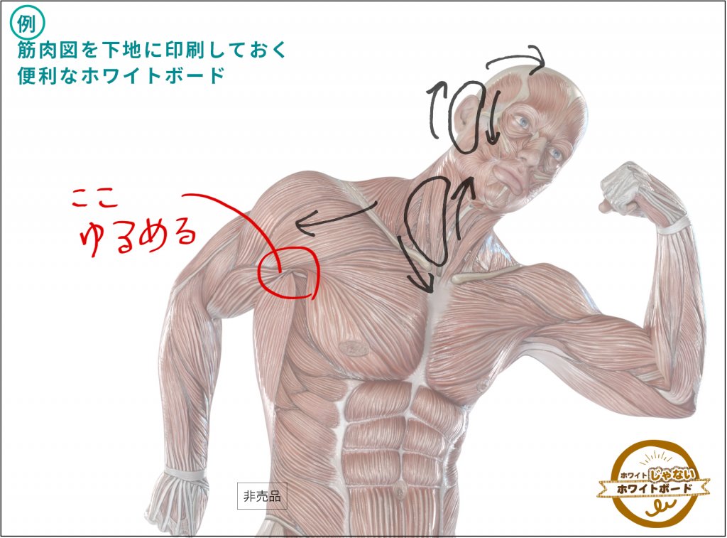 例：筋肉図を下地に印刷しておく便利なホワイトボード